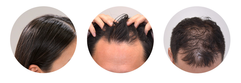 ビタブリッドcヘアーの効果 ビタブリッドcヘアー激安 通販はココ